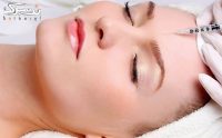 تزریق بوتاکس نواحی و تمام صورت در کلینیک طلایی