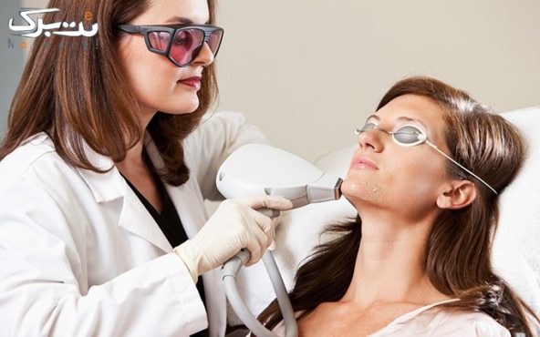 لیزر SHR در مطب دکتر موسوی